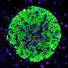 Image of a mouse pancreatic islet, regions in the pancreas that contain beta cells which secret insulin. The HASTER regulatory element has been knocked out in this mouse, resulting in changes to beta cell function that cause diabetes. Credit: Miguel A Garriga/
